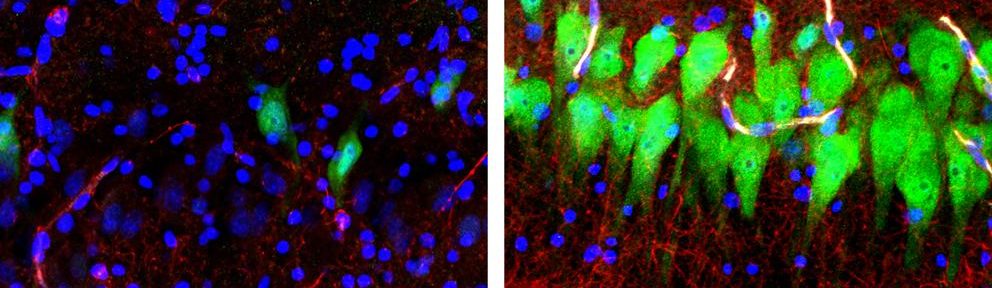 Logran “resucitar” parte de un cerebro animal y se abre una brecha entre la vida y la muerte