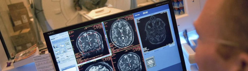 El atlas del cerebro humano: tras una investigación de 15 años, lograron descifrar todos sus secretos