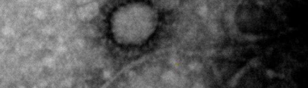 La primera foto del coronavirus que circula en la Argentina