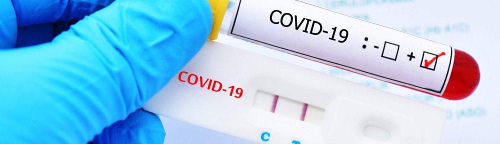 Científicos de universidades  nacionales desarrollan más tests de coronavirus con técnicas innovadoras