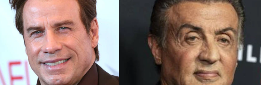 Antes y después: seis estrellas de Hollywood que fueron víctimas de la cirugía plástica