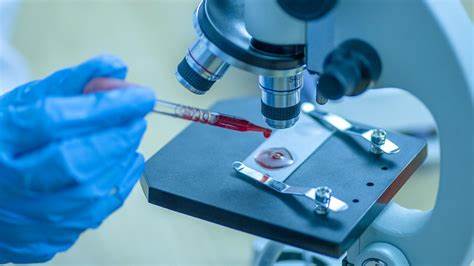 Crearon el primer anticuerpo que frena la metástasis en tumores sólidos y ataca solo a las células madre cancerosas