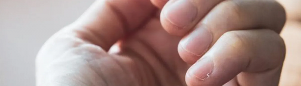 Cómo tus uñas te advierten sobre tu salud y ayudan a detectar enfermedades