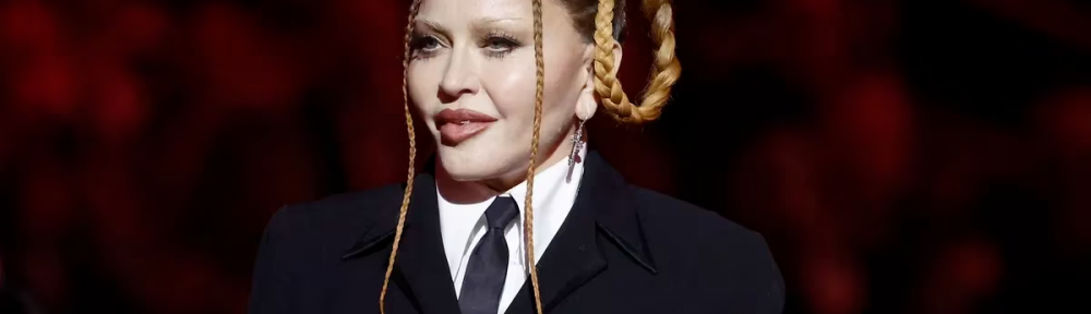 El irónico posteo de Madonna por las críticas a su rostro: “Miren lo linda que estoy ahora que la hinchazón de la operación ha bajado”