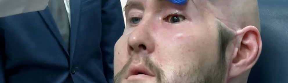 Avance de la ciencia: Un hombre recibe con éxito el primer trasplante de ojo completo en el mundo