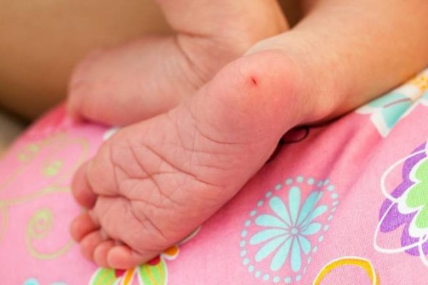 Fenilcetonuria (PKU): una enfermedad poco frecuente que afecta al cerebro pero detectada a tiempo sus consecuencias son prevenibles